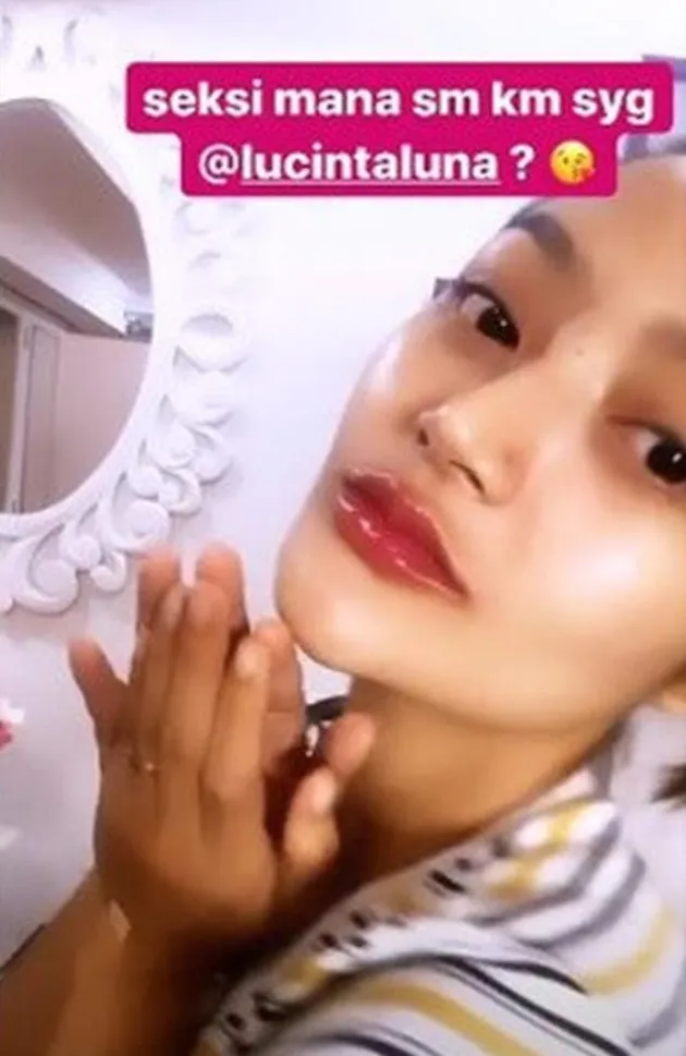 siti badriah, siti badriah filler bibir, pernikahan sitri badriah