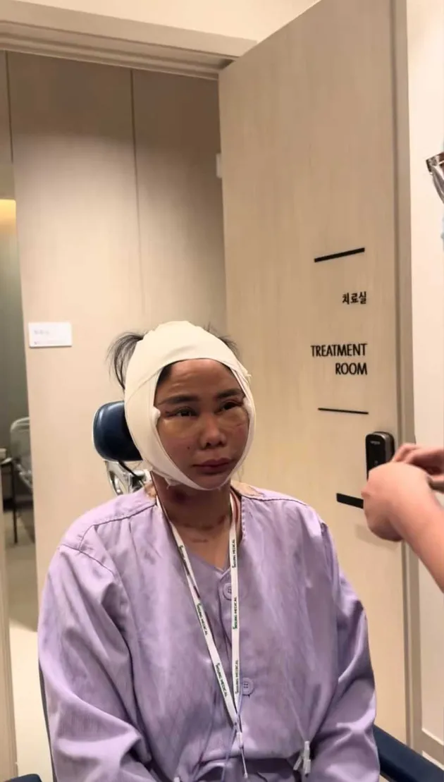 Denise Chariesta Oplas di Korea