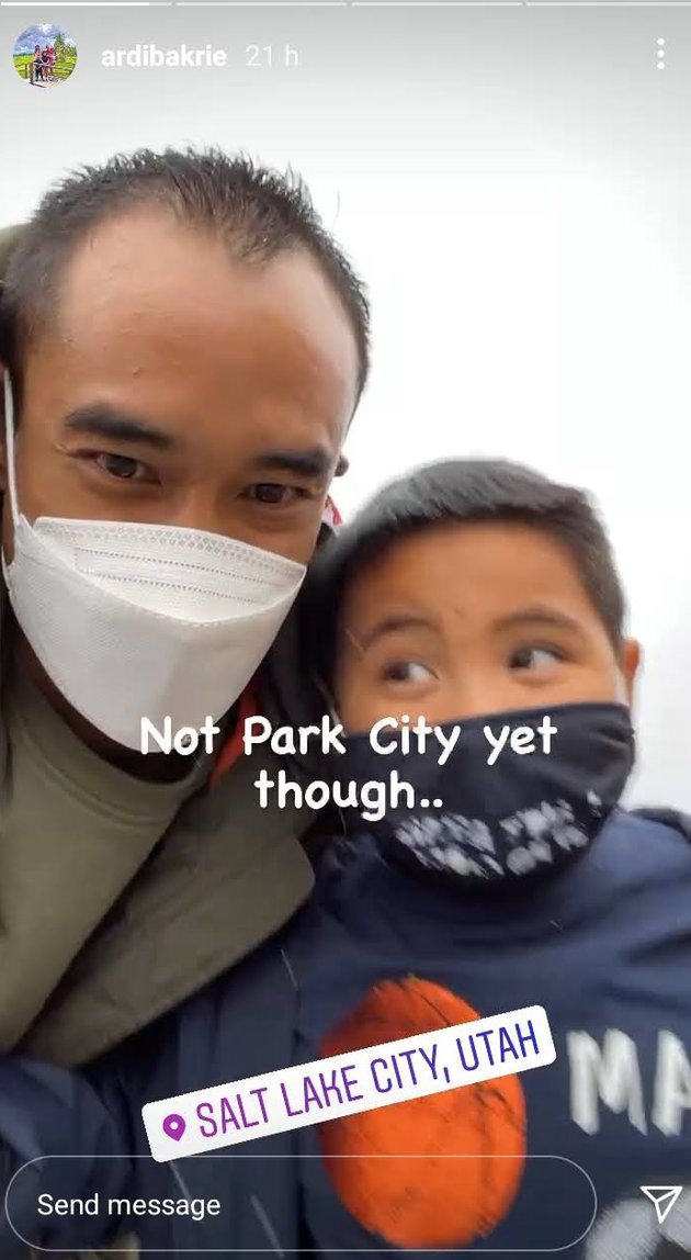 <nil>