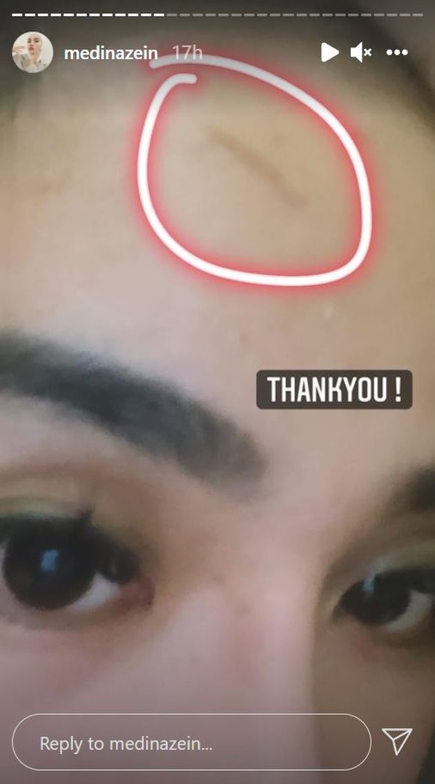 <nil>