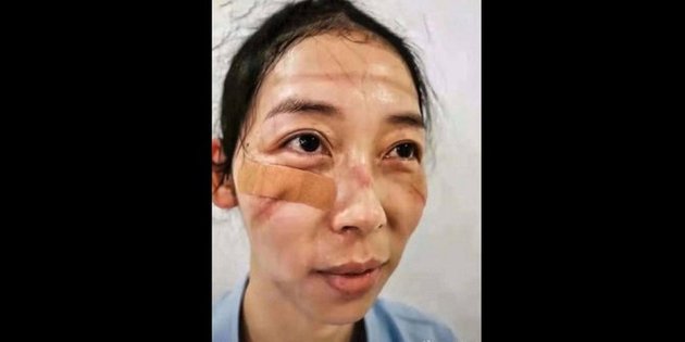 7 Portraits of Nurses in Chinese Hospitals Who Participate in Handling the Corona Outbreak, Faces Full of Wounds & Fatigue Lines