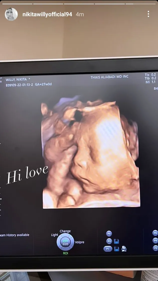 Perjalanan Kehamilan Nikita Willy