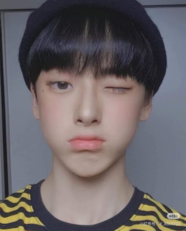 <nil>