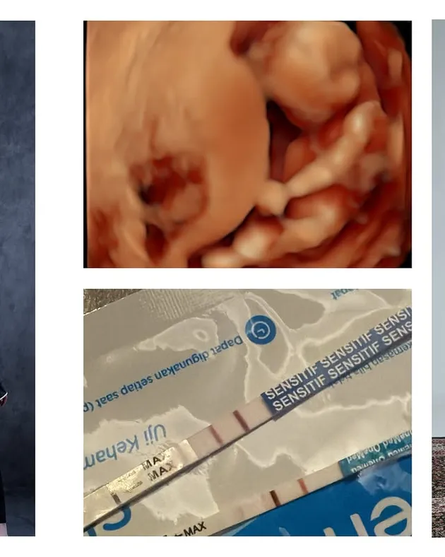 7 Photos of Rigen Rakelna and His Wife Announcing Pregnancy with Their ...