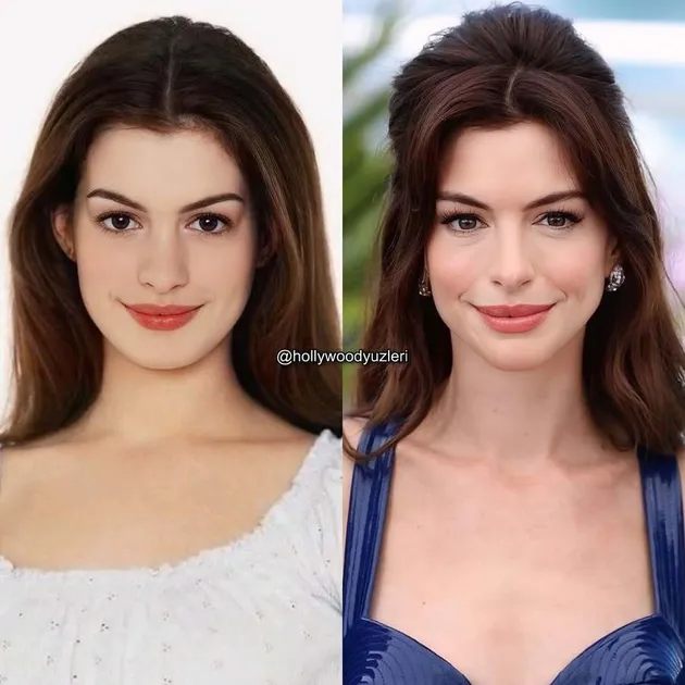 Potret Anne Hathaway