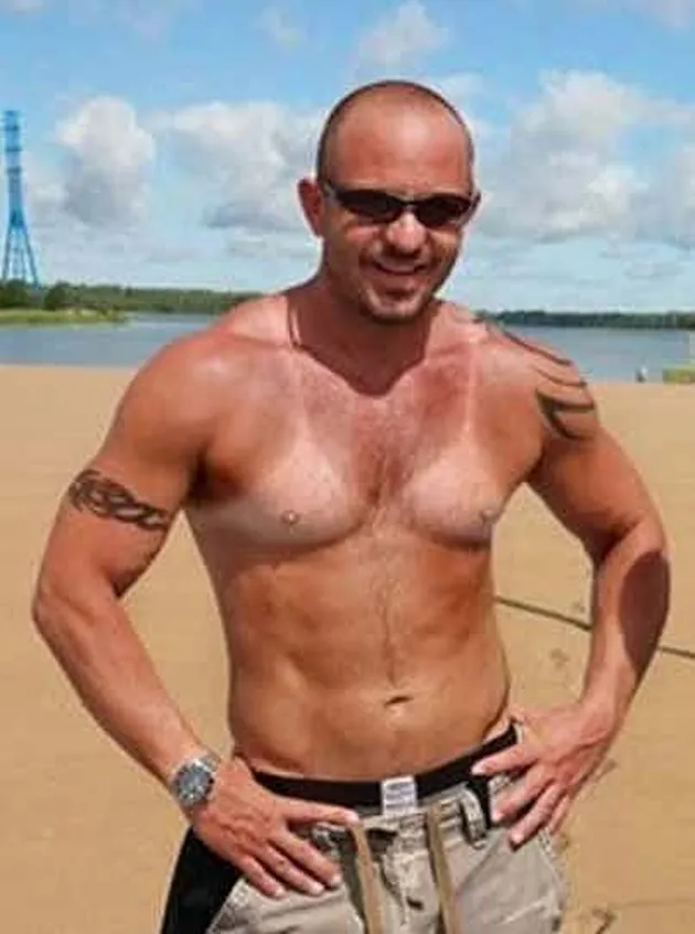 sunburn, bekas matahari, kelamaan berjemur, luka bakar kulit