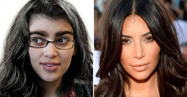 8 FOTO KELUARGA KARDASHIAN SEBELUM & SESUDAH OPERASI, BEDA 