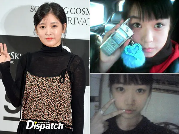 Seleb Korea Operasi plastik