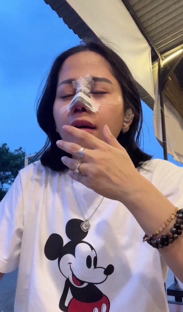 8 Portraits of Farida Nurhan's Nose Plastic Surgery Again, Doesn't Want to be Called Suneo - Criticized by Netizens: Licking Own Spit