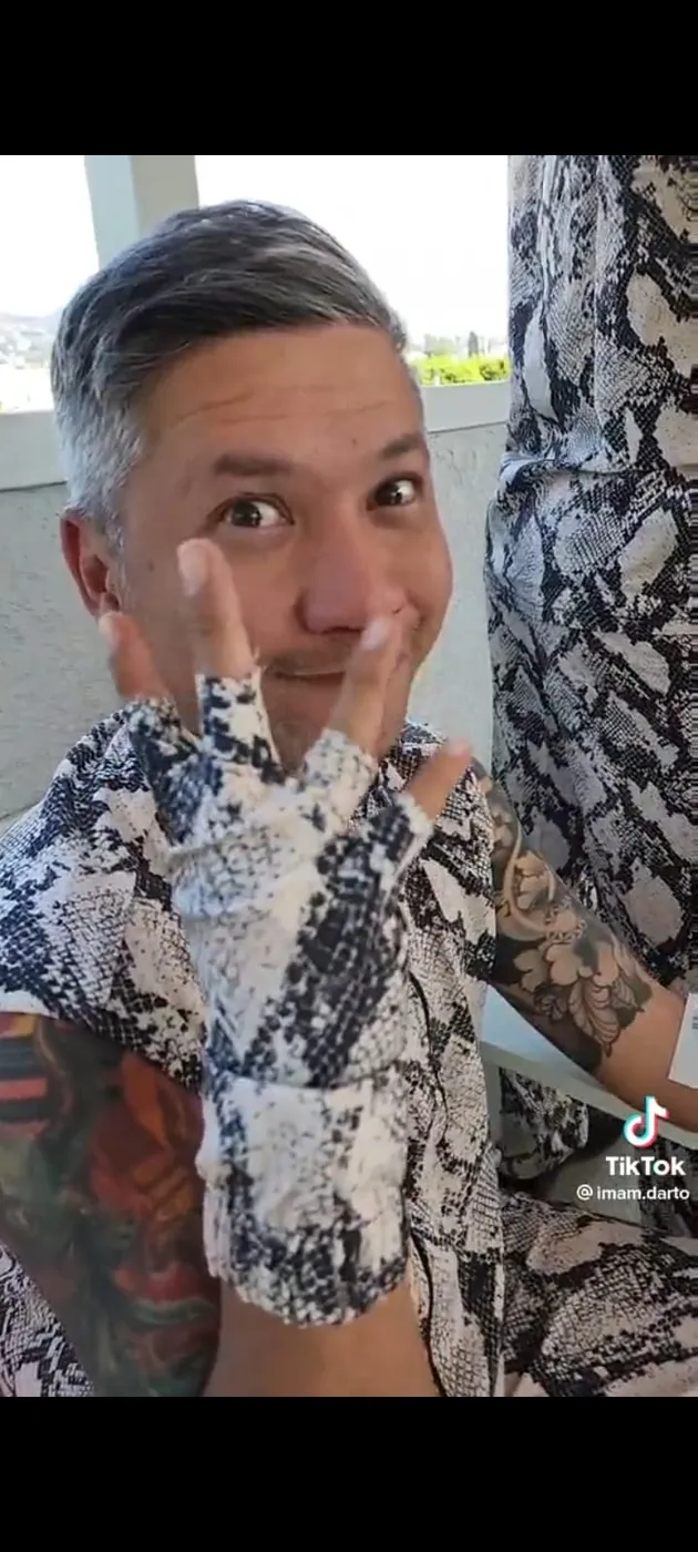 <nil>