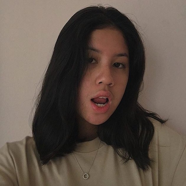 <nil>