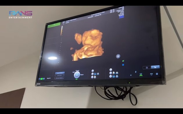 9 Portraits of Nagita Slavina Checking Pregnancy Accompanied by Mama Rieta, She Panicked and Second Child Clearly Seen During DNA Test - His Nose Resembles Raffi Ahmad