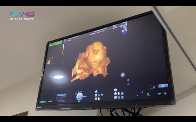 9 Portraits of Nagita Slavina Checking Pregnancy Accompanied by Mama Rieta, She Panicked and Second Child Clearly Seen During DNA Test - His Nose Resembles Raffi Ahmad