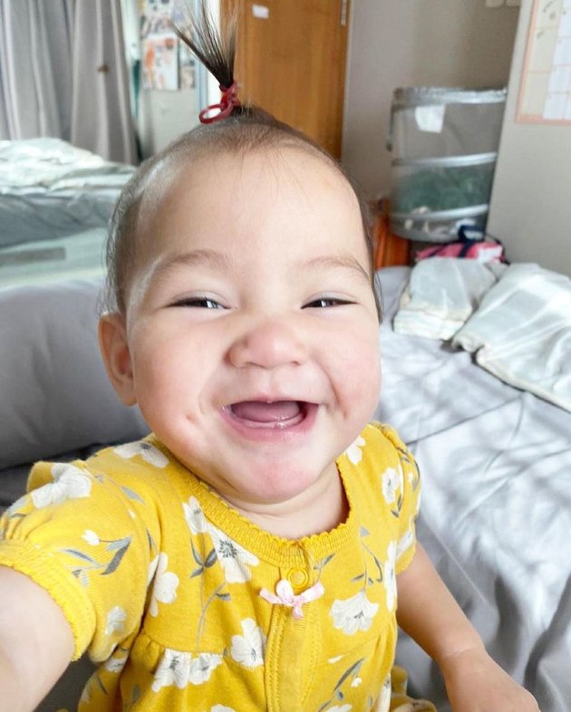 8 Latest Portraits of Mona Ratuliu's Youngest Daughter who Previously Experienced Skin Disorder, Now Fully Recovered, Even Cuter and More Adorable