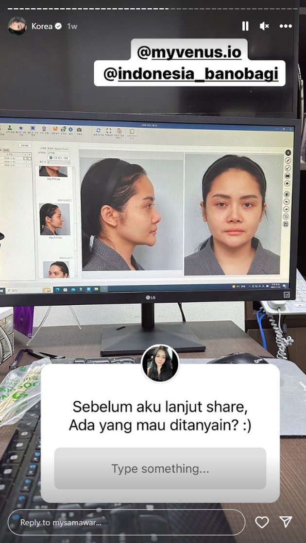 <nil>