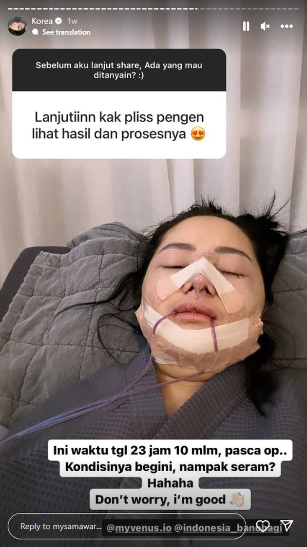 <nil>