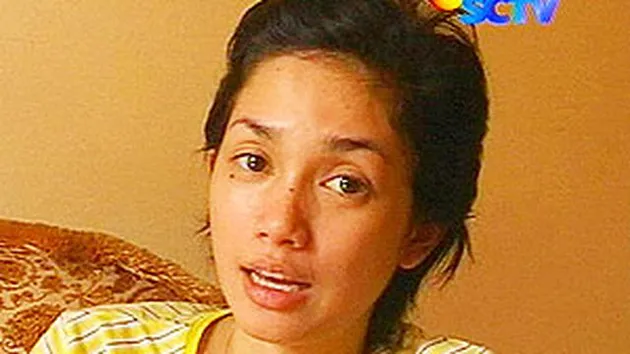 ussy tahi lalat, tahi lalat ussy