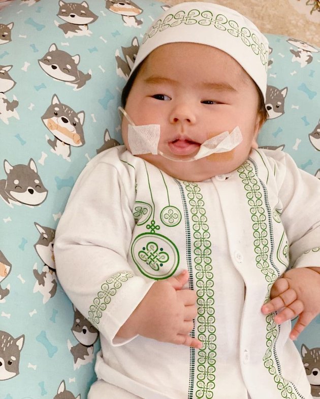 Masih teringat sosok mungil baby Sulaiman dengan selang terpasang pada wajahnya lantaran kelainan bawaan pada tulang rawan laring yang menyebabkan risiko asupan makanan masuk ke saluran pernapasan.