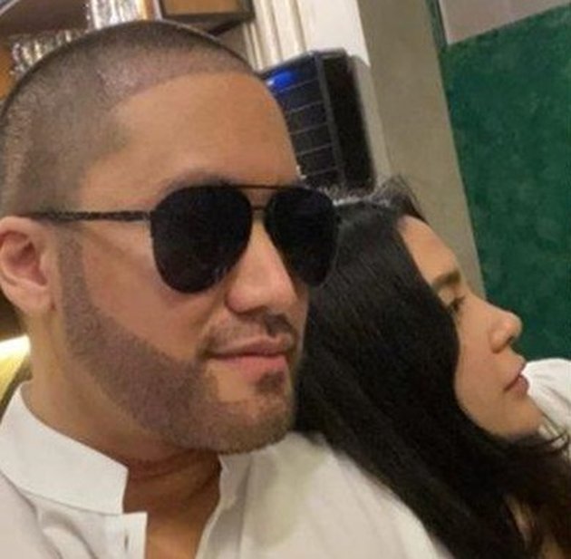9 Photos of Kevin Aprilio with His New Beard Appearance, Revealing the Main Reason for Hair Transplantation on His Forehead and Face