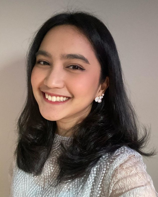 9 Photos of Rachel Amanda Looking Like a Teenager at 26 Years Old, Netizens: So Beautiful I Want to Cry!