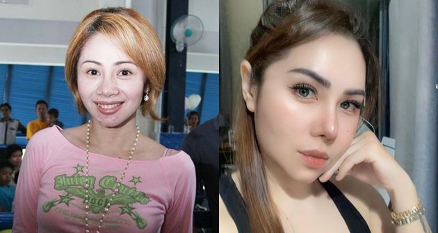 9 Portraits Before - After Celebrities Do Plastic Surgery, Some Are Very Different From Their Old Photos