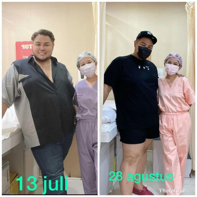 9 Portraits of Ivan Gunawan's Transformation After Diet, Successfully Losing 20 Kg in One Month - Looking Handsome!