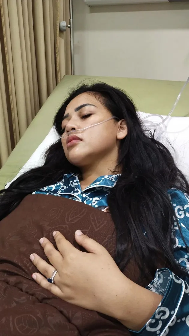 Potret kondisi terkini Clara gopa yang disebut kena guna-guna