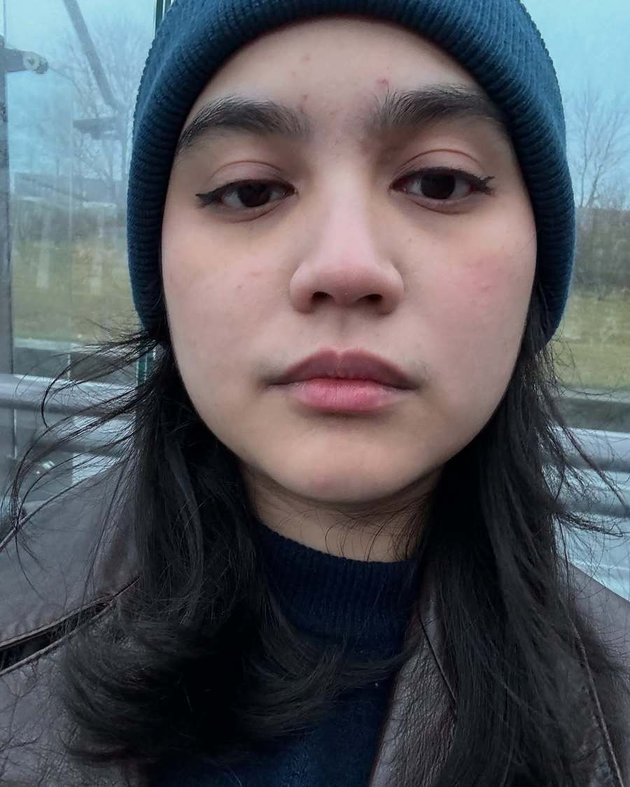 <nil>
