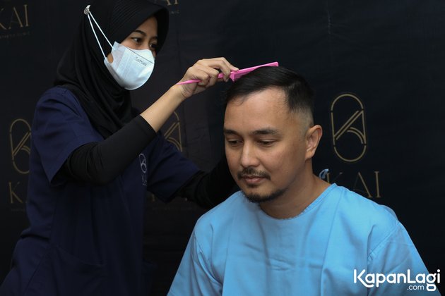 From Experiencing Baldness to a Crisis of Confidence, Take a Look at Dimas Aditya's Hair Transplantation Portraits