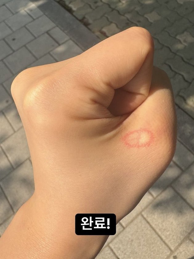 <nil>