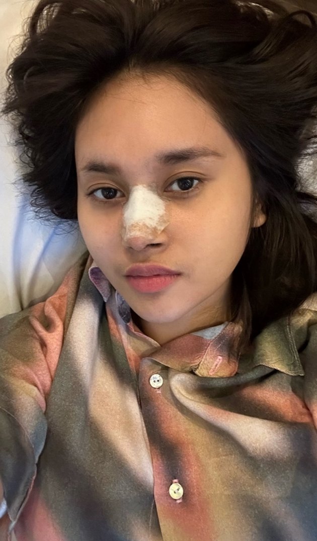 Just Had Another Plastic Surgery, 8 Pictures of Permesta Dhyaz's New Nose That Netizens Criticize - Said to be Prettier Before