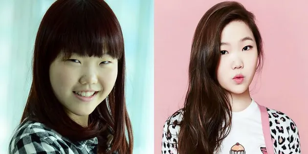 artis YG Entertainment