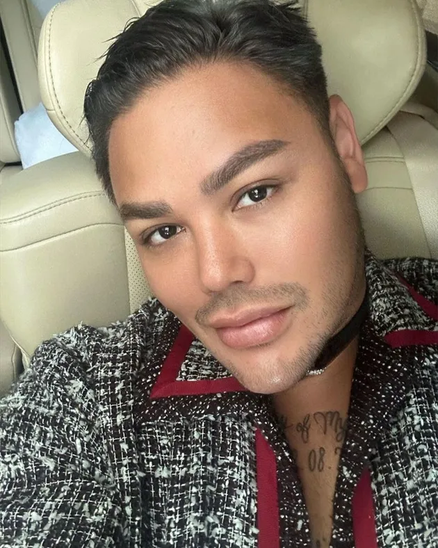 Bibir Ivan Gunawan Tebal