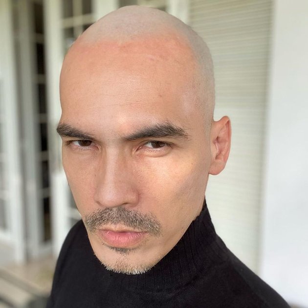 Astonishing! 9 Latest Photos of Atalarik Syach with a Bald Head - Used to Lack Confidence