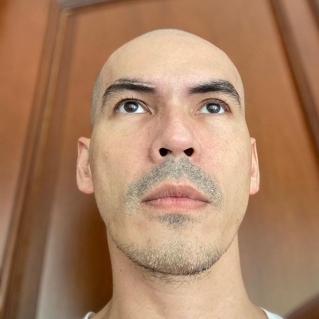Astonishing! 9 Latest Photos of Atalarik Syach with a Bald Head - Used to Lack Confidence