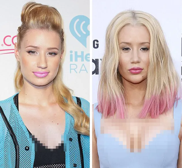 Iggy Azalea
