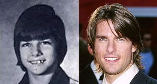 seleb_dan_perubahannya