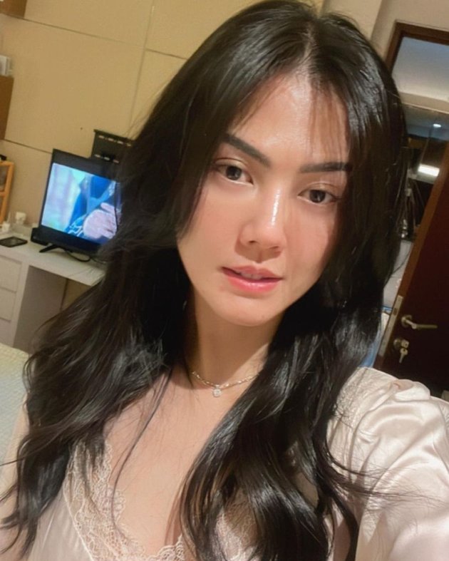 Natural Beauty! 8 Portraits of Nita Gunawan without Makeup, Called a Combination of Agnez Mo and Revalina S Temat