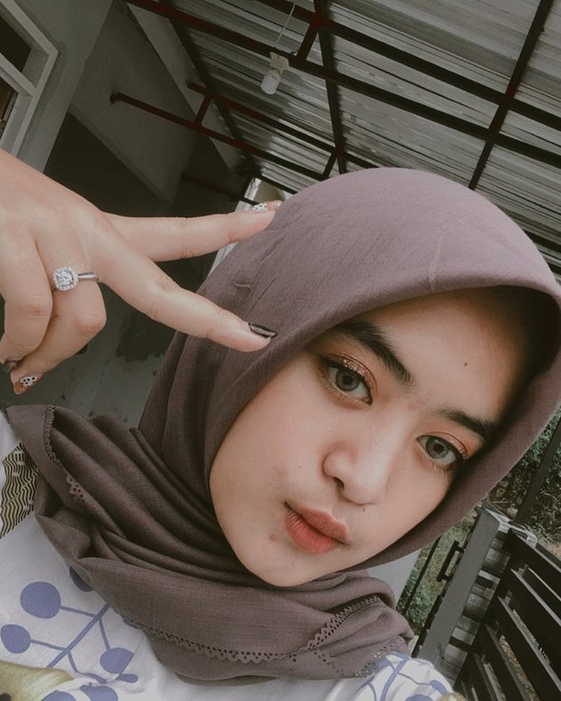 <nil>