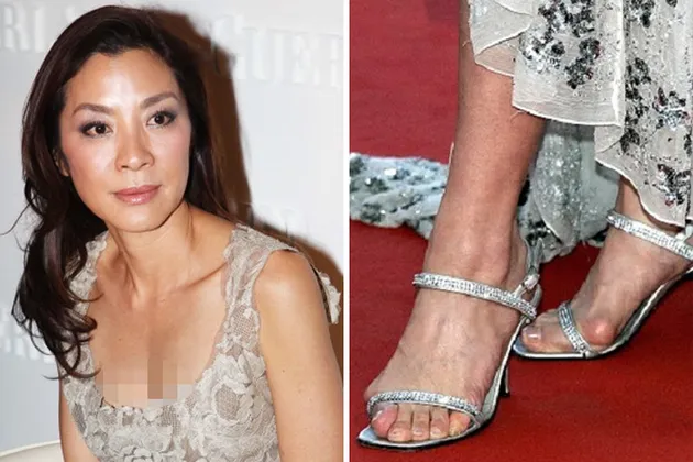 Artis Dengan Kaki Terburuk di Dunia