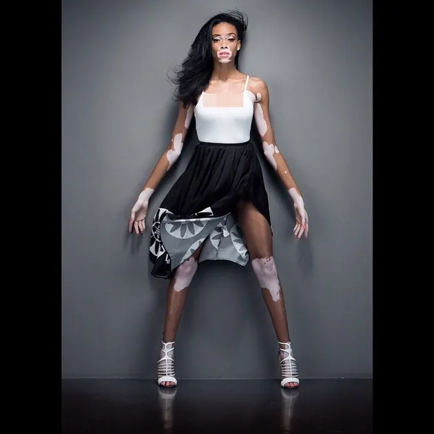 Chantelle Winnie