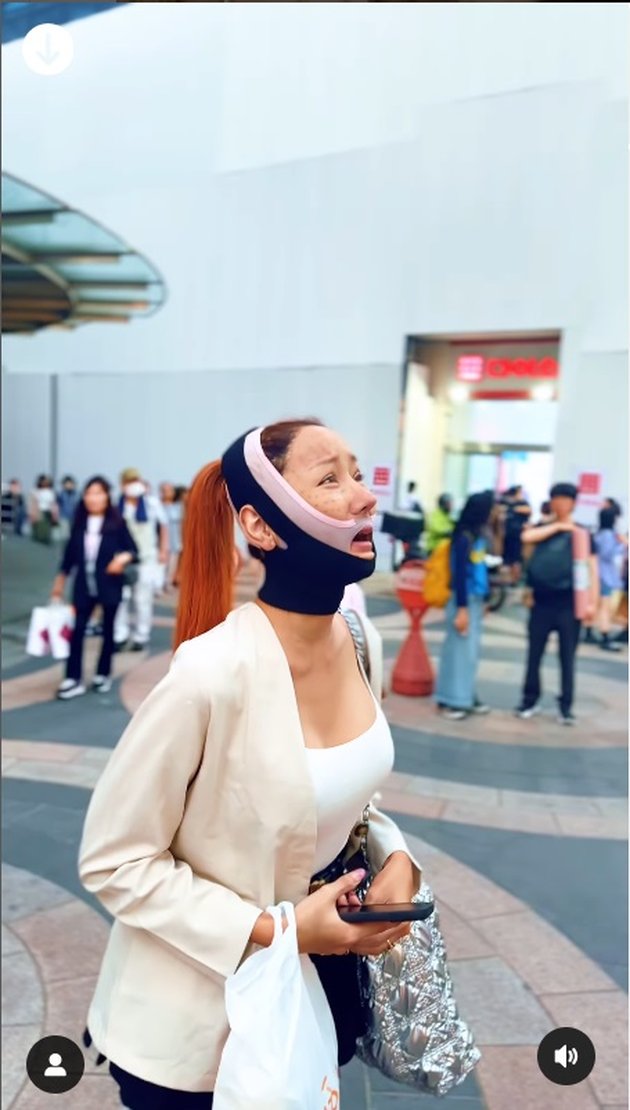 Cueki Cibiran, 8 Latest Portraits of Lucinta Luna Confidently Walking with a Face Full of Tools After Plastic Surgery in Korea - Definition of Being Criticized but Still Calm