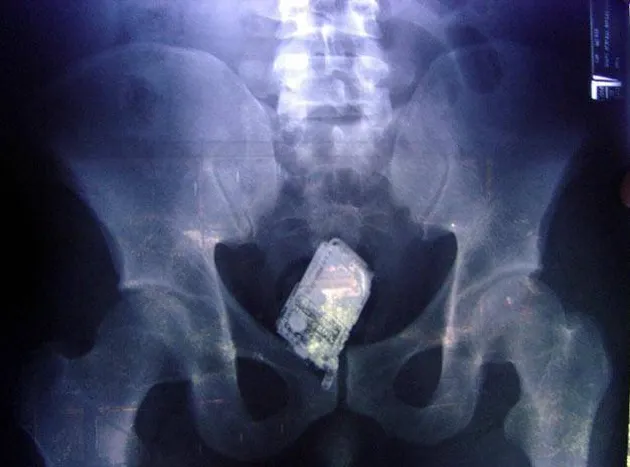 benda aneh, kelakuan aneh, benda aneh, info unik