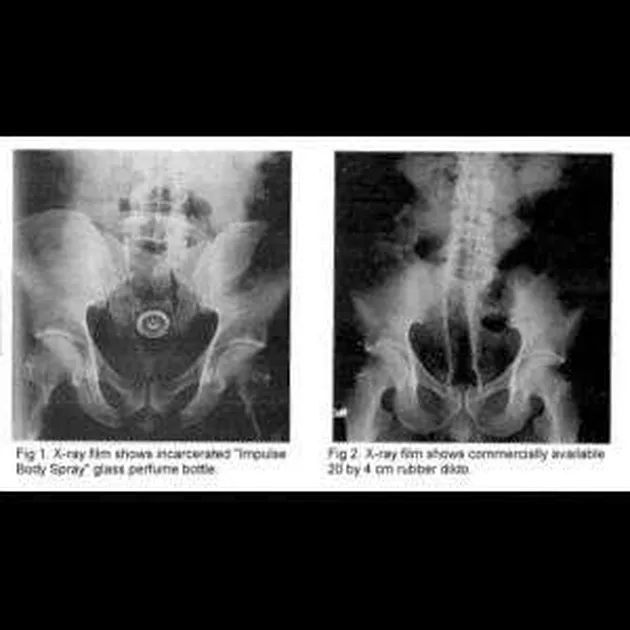 benda aneh, kelakuan aneh, benda aneh, info unik