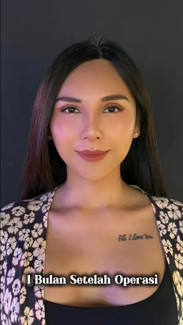 Dena Rachman setelah sebulan oplas