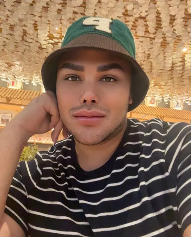 Bibir Tebal Ivan Gunawan