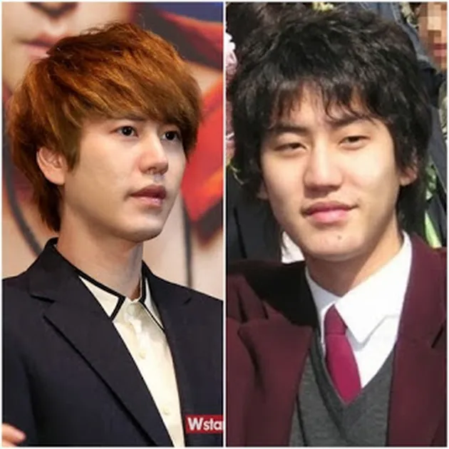 Artis Korea Operasi Plastik