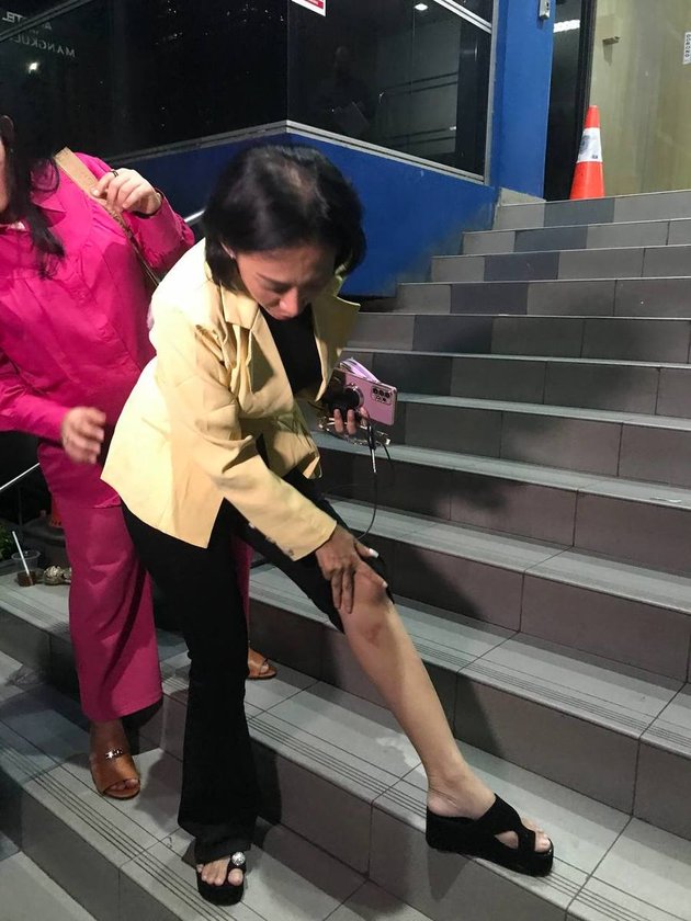 Dewi Sanca Reports Man Who Assaulted Her Until Her Legs Bruised, Suspected Member