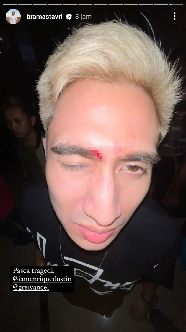 <nil>