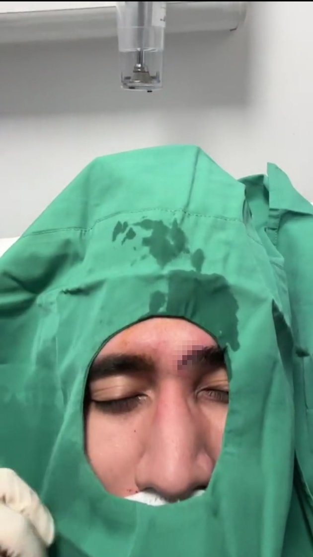 <nil>
